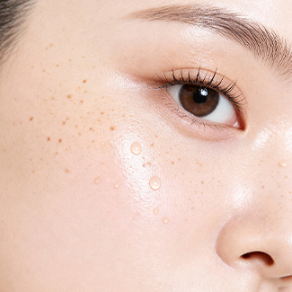 색소·잡티 치료 이미지